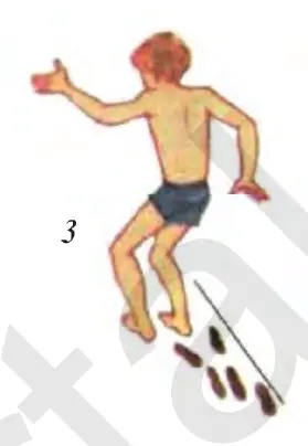 68-rasm. Miyachasi zararlangan odamning xatti-harakatlari: 1 – miyacha, 2 – burun uchiga tegishda barmoqning titrashi, 3 – chayqalib yurish, 4 – muvozanatning buzilishi, 5 – yozuvning buzilishi.